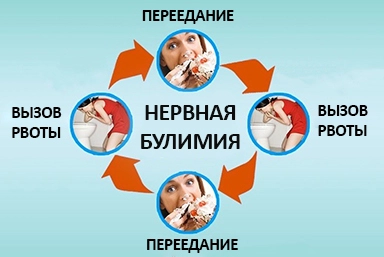 Лечение булимии в Колпашево